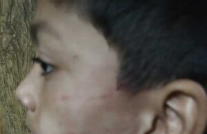 बिंदुखत्ता 👉 डिफेंस एकेडमी कोचिंग क्लास के संचालक द्वारा की गई मासूम छात्र की पिटाई छात्र बुरी तरीके से जख्मी 👉 घायल छात्र के परिजनों ने पुलिस से लगाई गुहार