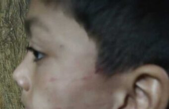 बिंदुखत्ता 👉 डिफेंस एकेडमी कोचिंग क्लास के संचालक द्वारा की गई मासूम छात्र की पिटाई छात्र बुरी तरीके से जख्मी 👉 घायल छात्र के परिजनों ने पुलिस से लगाई गुहार